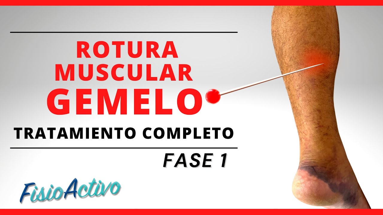 como tratar una rotura fibrilar en el gemelo