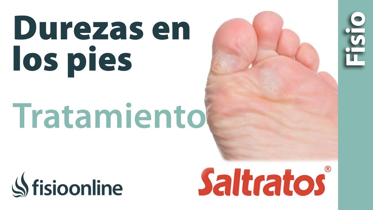 durezas en la planta del pie dolorosas