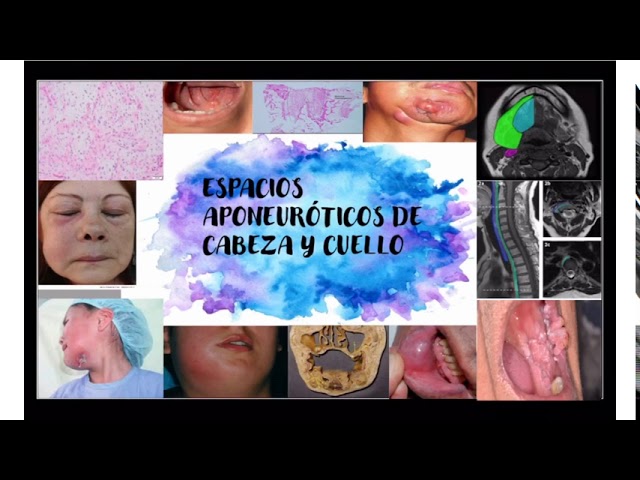 espacios anatomicos de cabeza y cuello