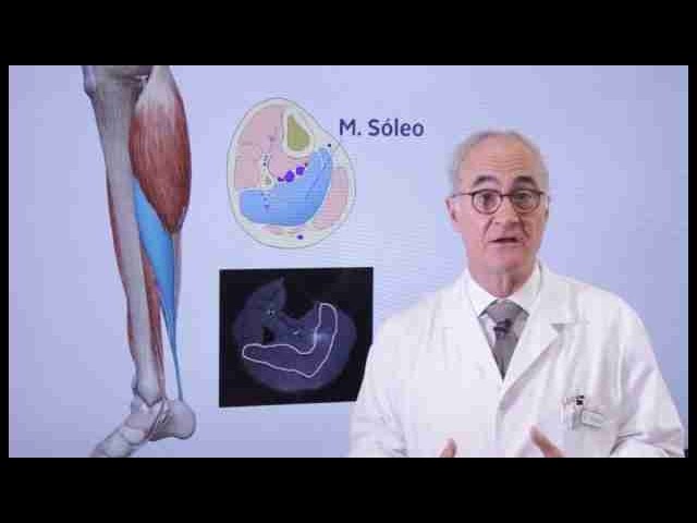 dolor en gemelo al ponerse de puntillas