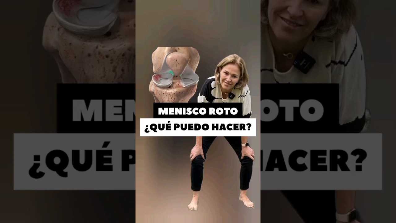 es bueno andar con el menisco roto