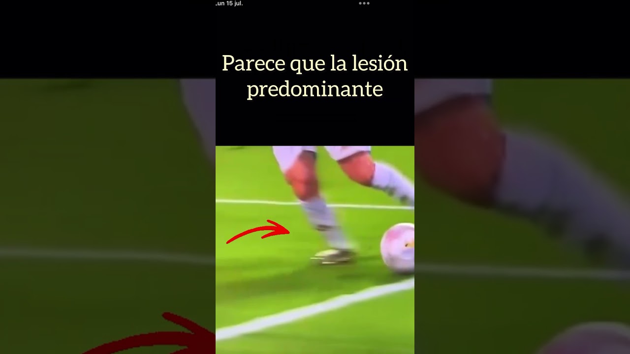 esguince de tobillo en jugadores de futbol