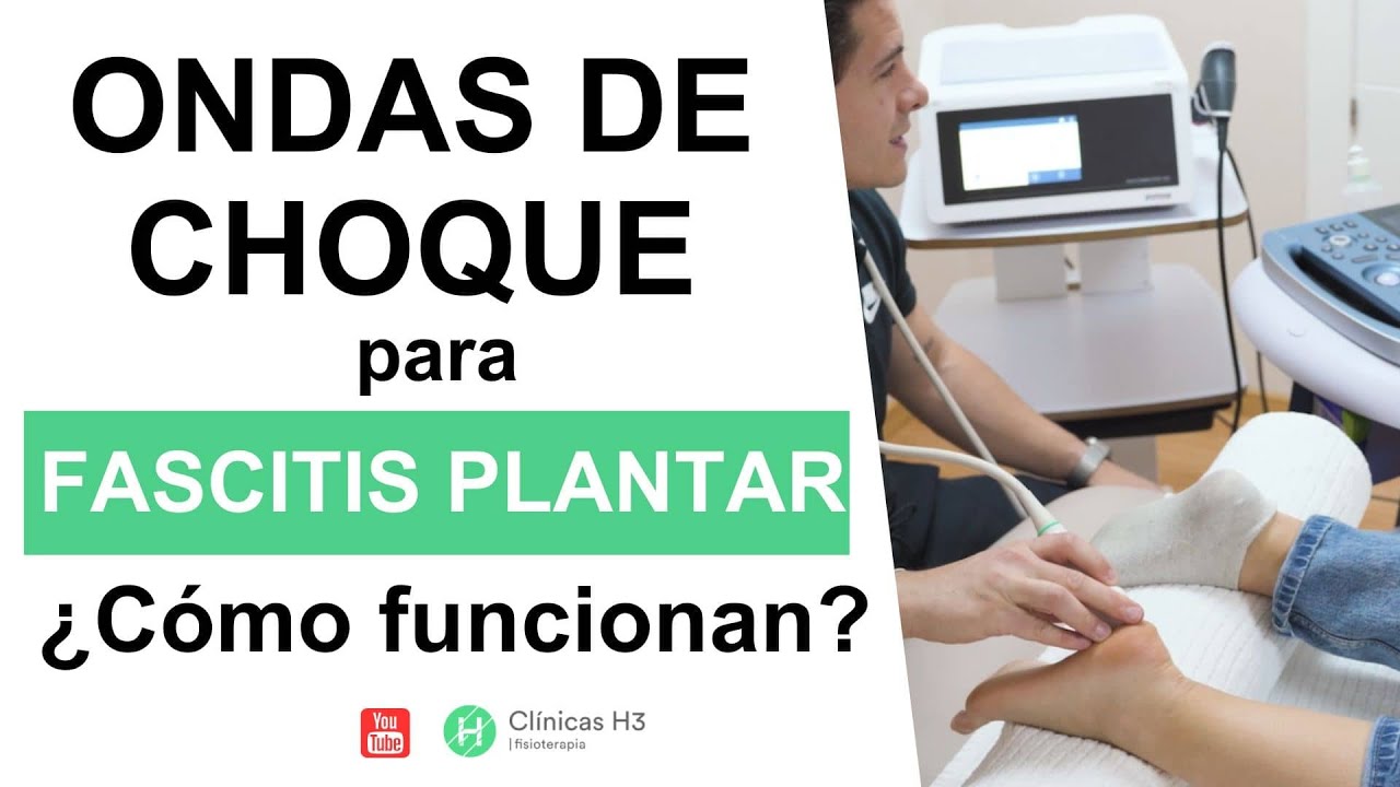 fascitis plantar y ondas de choque