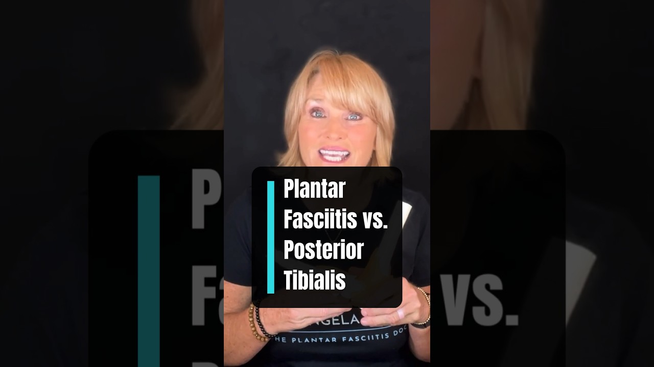 fascitis plantar y tendinitis tibial posterior