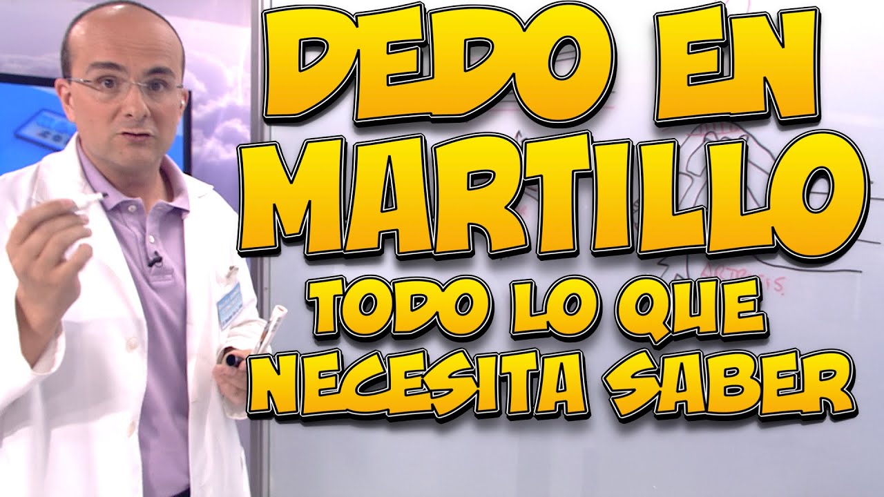 remedio casero para el dolor del dedo martillo del pie