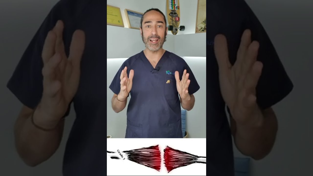 rotura fibrilar gemelo tiempo de baja