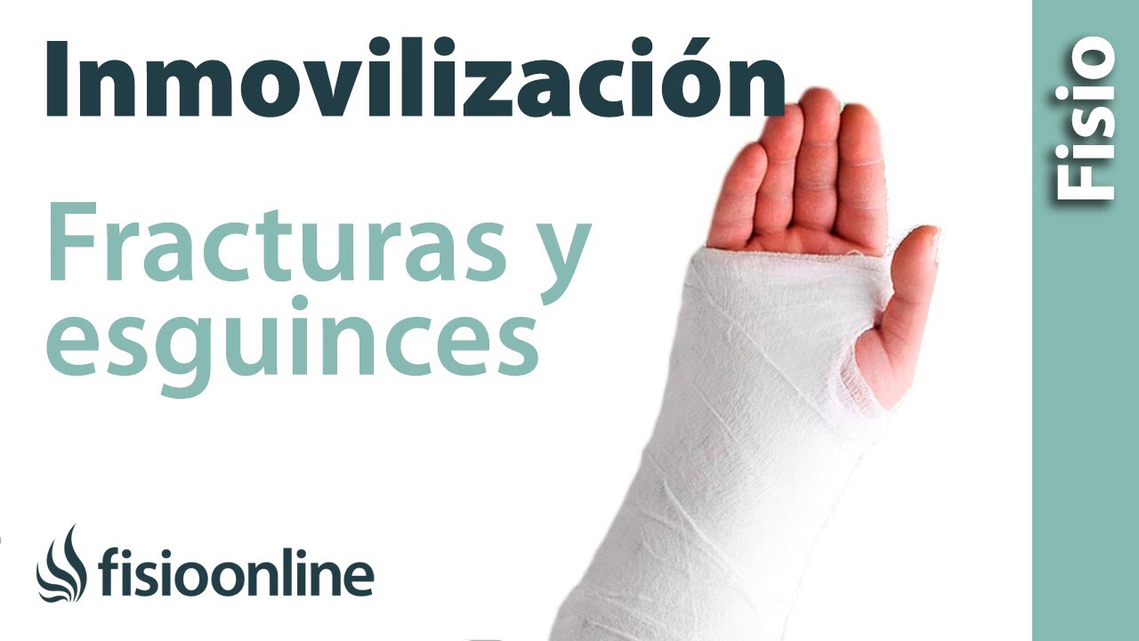 se puede conducir con una ferula en la mano