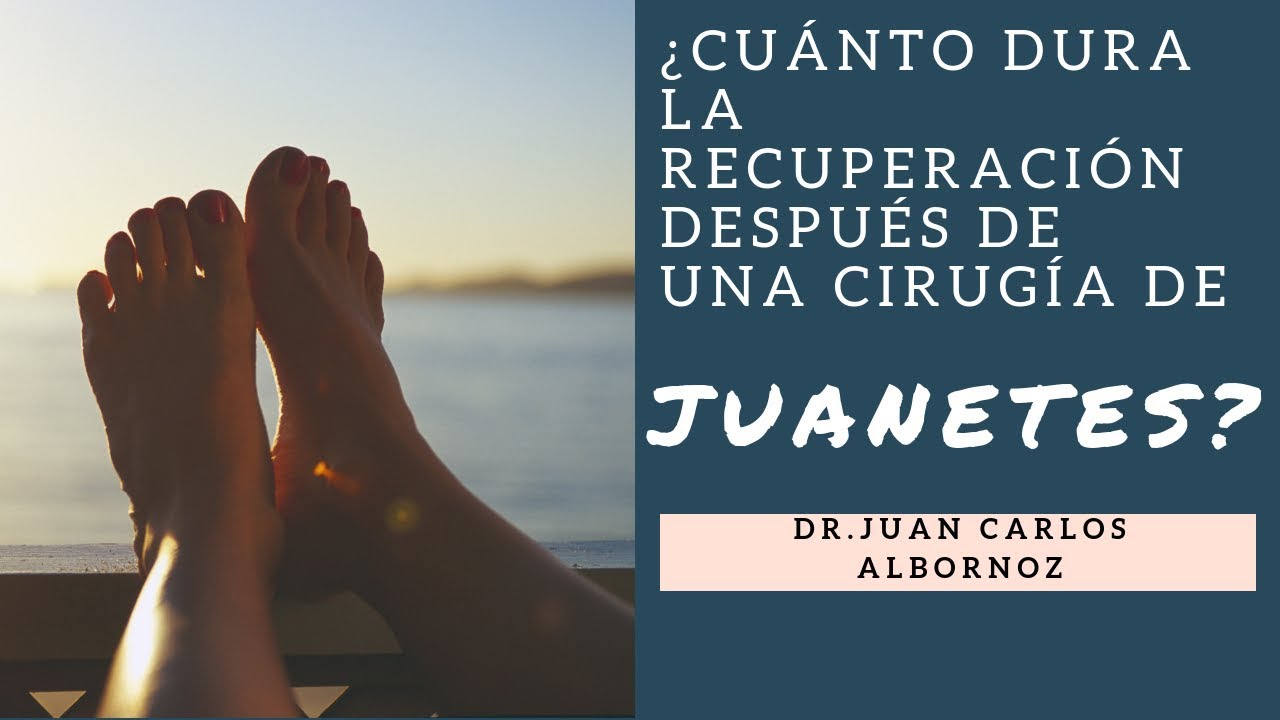 tiempo de baja laboral por operacion de juanetes