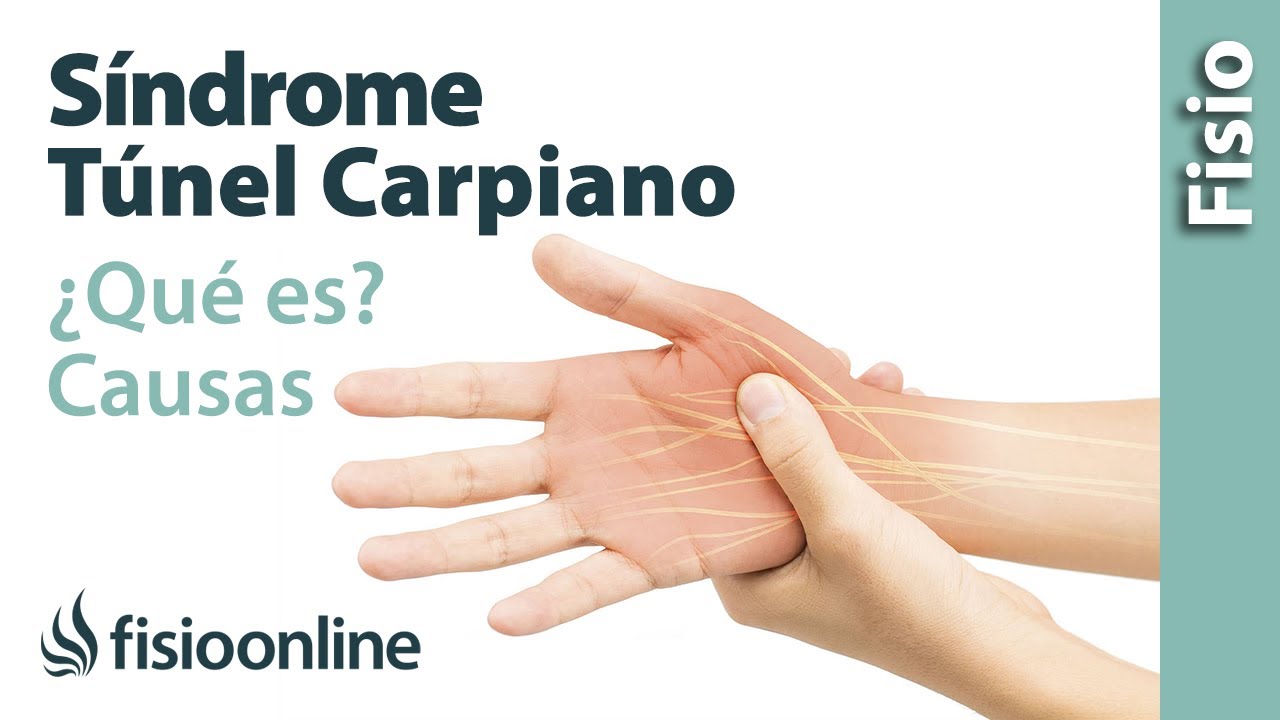 tratamiento fisioterapeutico sindrome del tunel carpiano