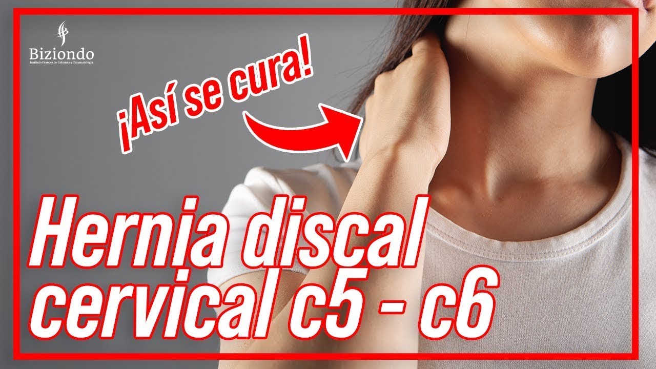 cual es la vertebra c5 y c6