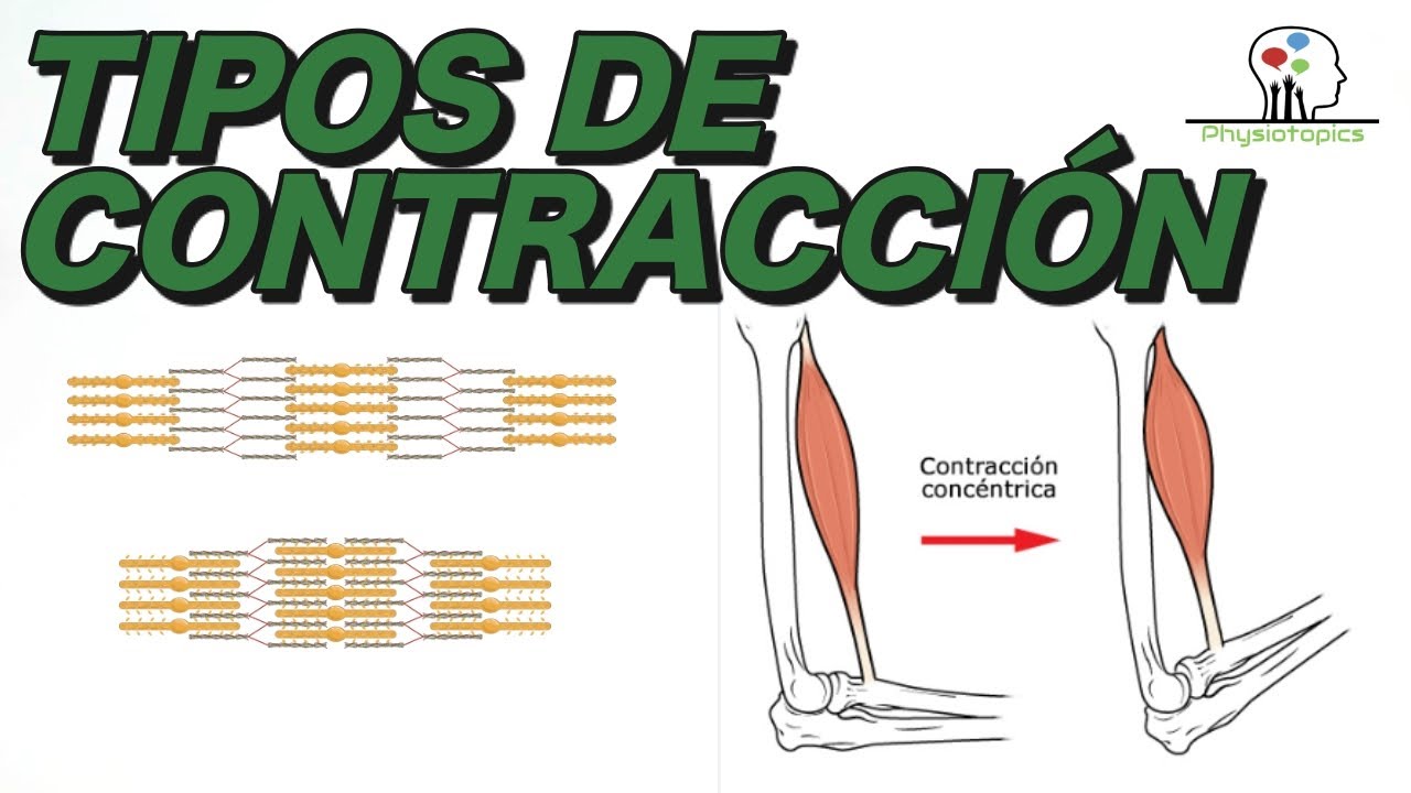 cuales son los tipos de contraccion muscular