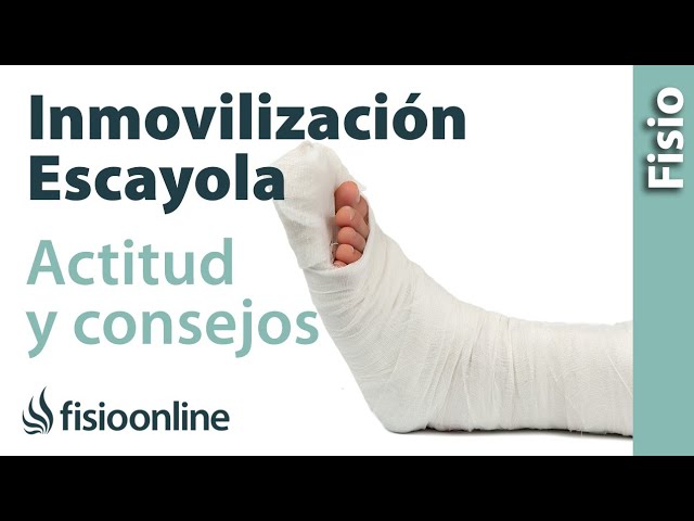 cuanto tiempo hay que llevar una escayola