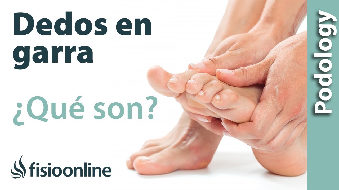deformacion de los dedos de los pies