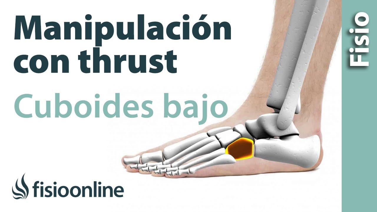 dolor en el hueso cuboides del pie