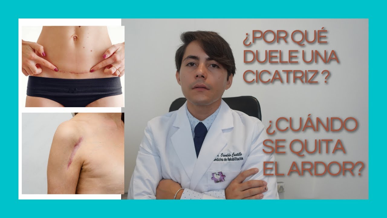 dolor en la cicatriz de la cesarea