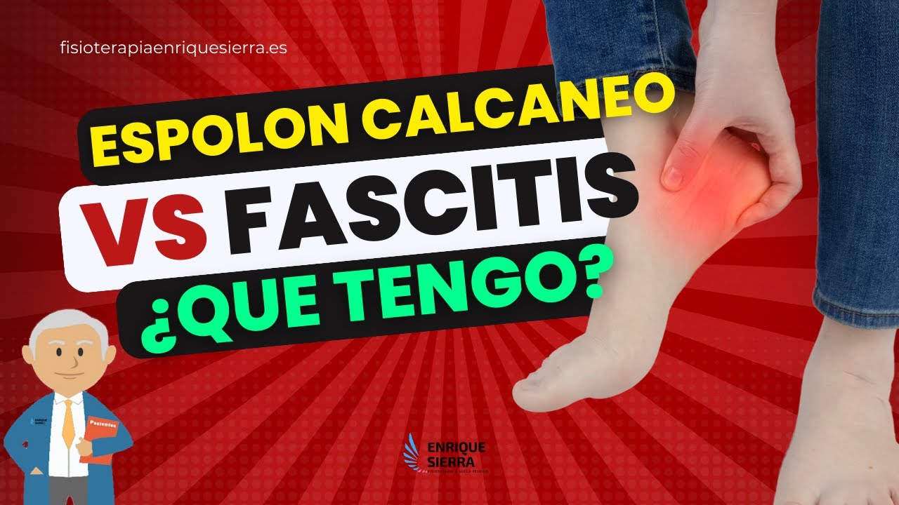 espolon calcaneo y fascitis plantar es lo mismo