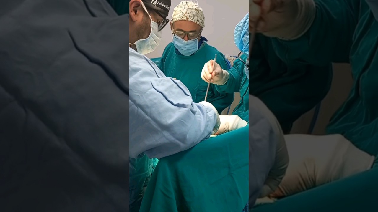 los tornillos puestos por una artrodesis lumbar son para siempre