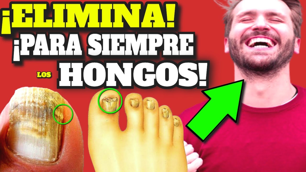 me he cortado demasiado la uña del pie