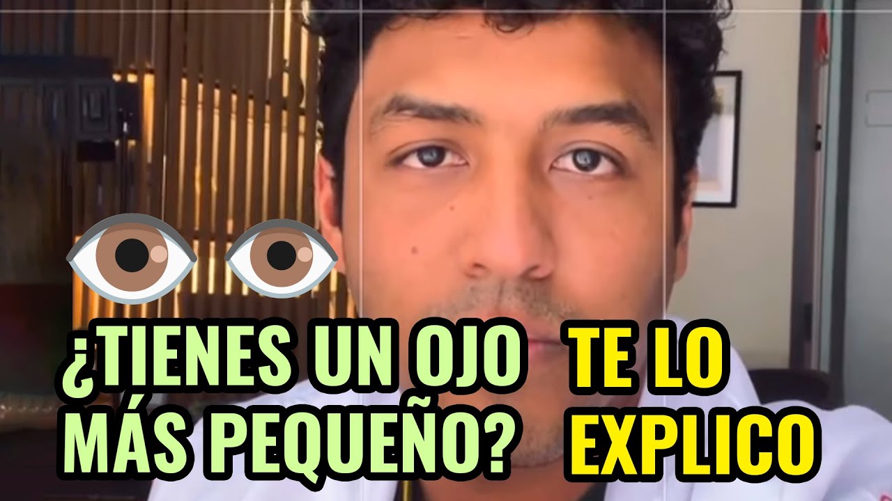 porque un ojo es mas pequeño que el otro