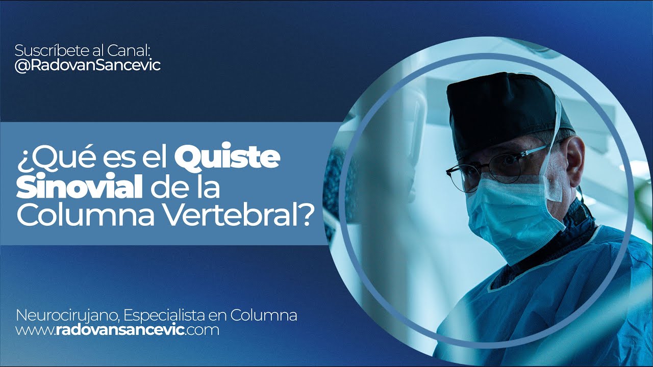 quiste sinovial en la columna vertebral