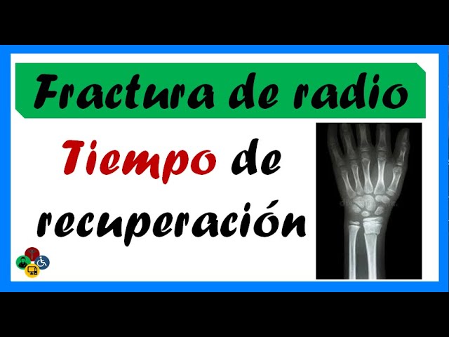 rotura de muñeca tiempo de baja