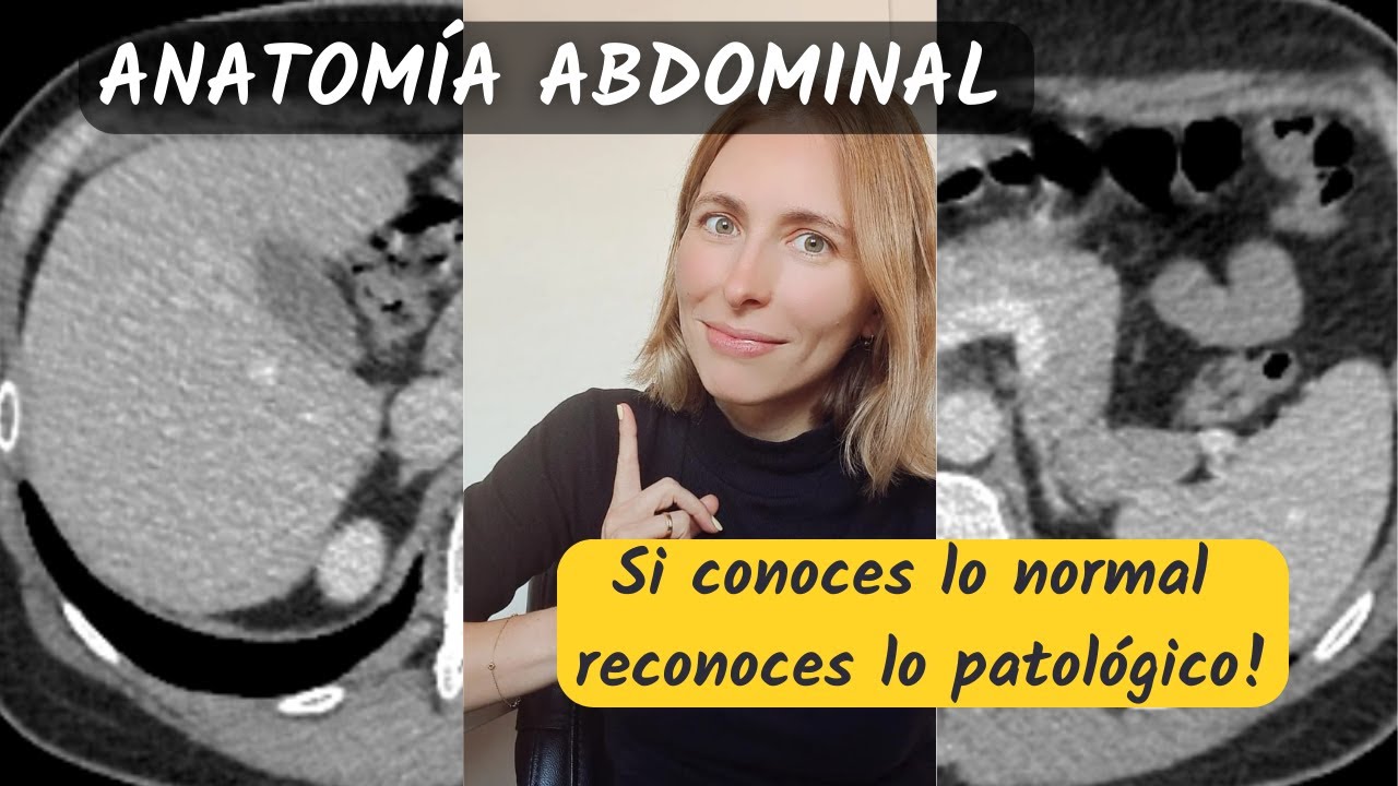 tac abdominal que organos se ven