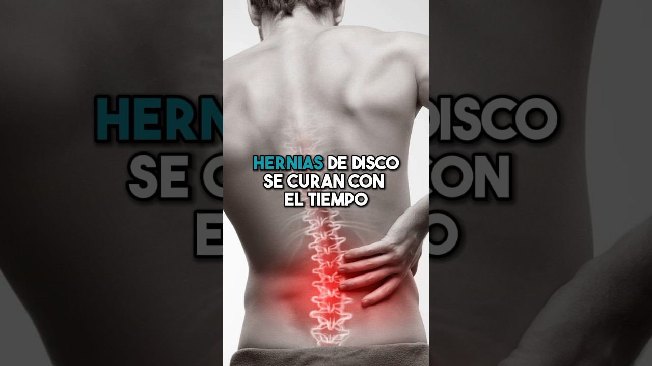 tiempo de baja por hernia discal cervical