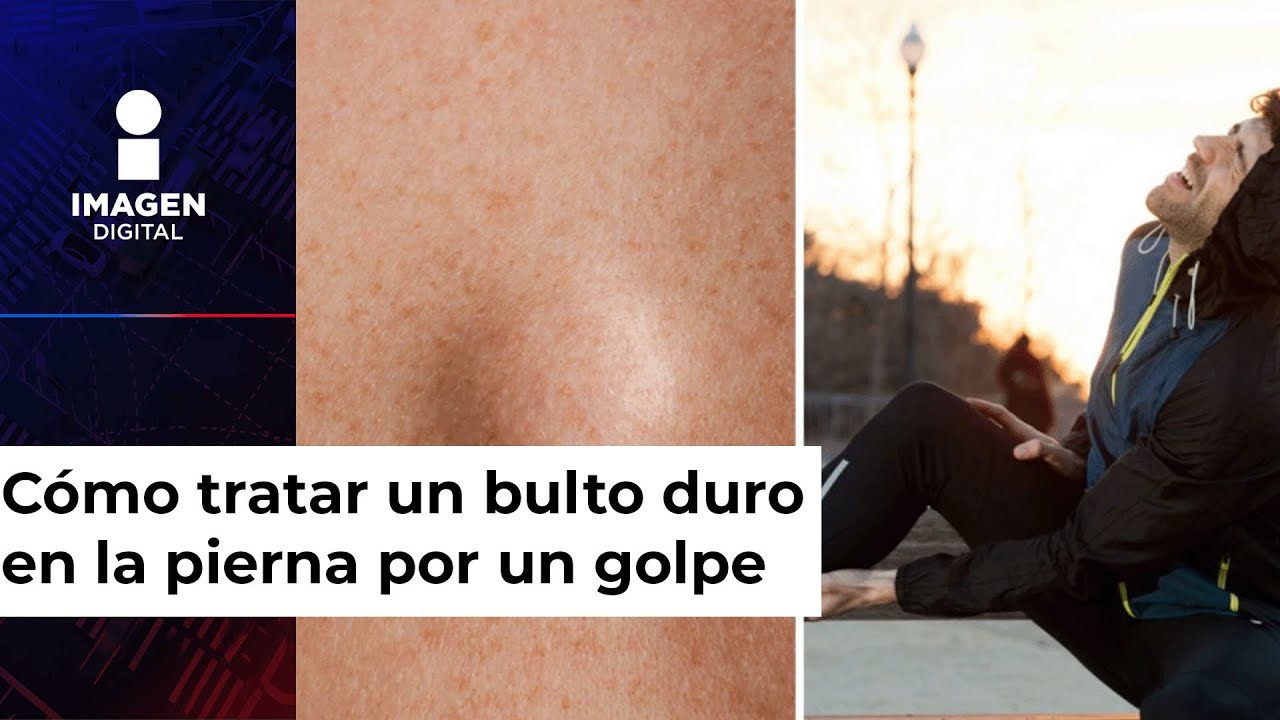 bulto en la pierna despues de un golpe