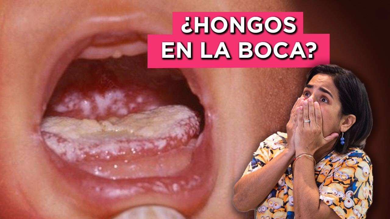 burbujas en la boca del bebe