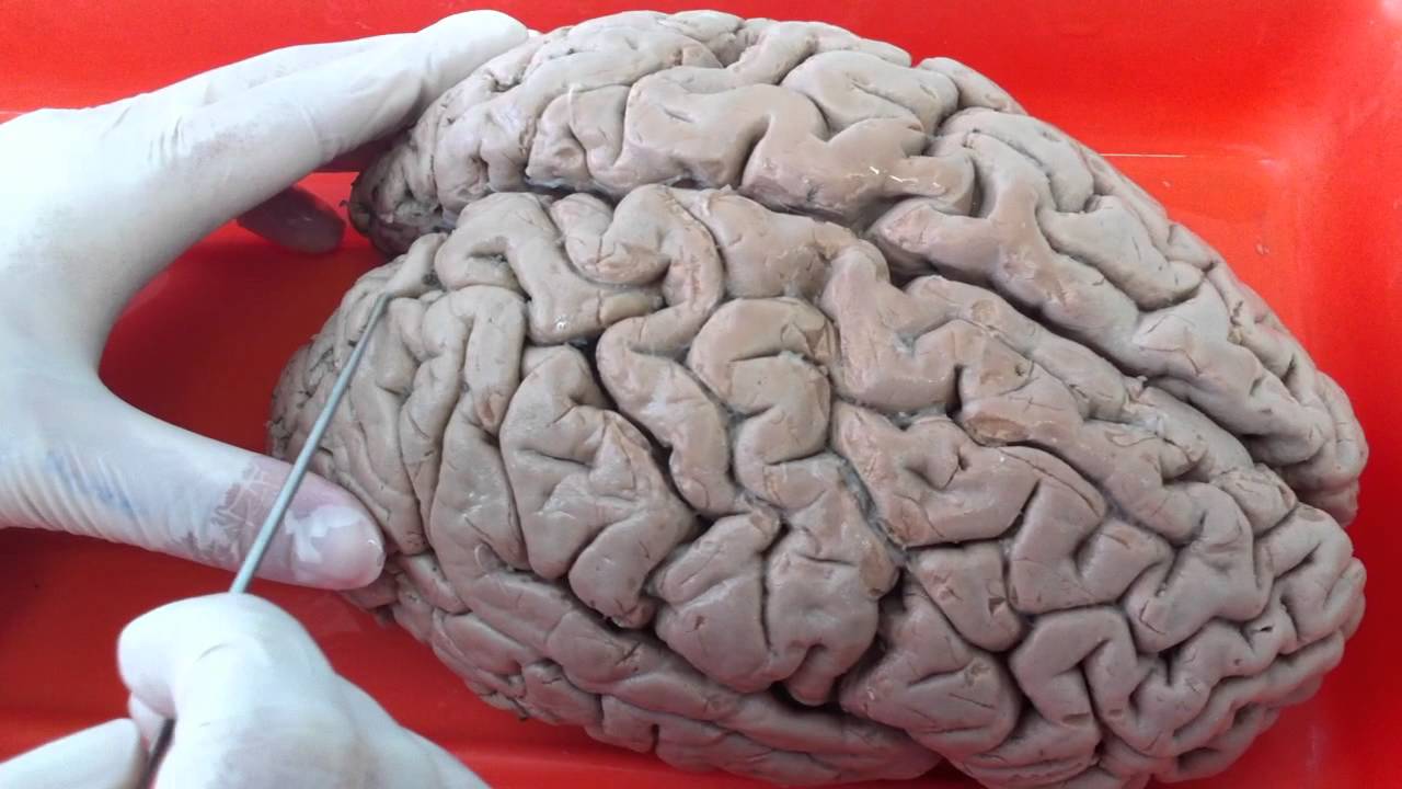 cisura que separa el lóbulo temporal y el frontal