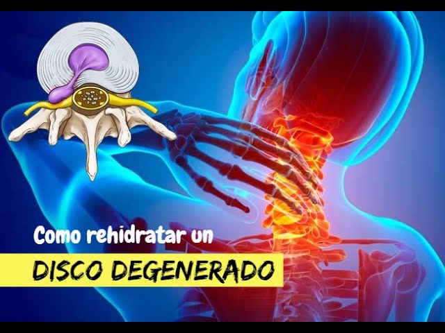 como hidratar los discos de la columna