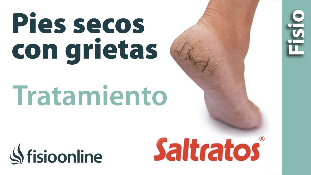 como tratar grietas en los pies