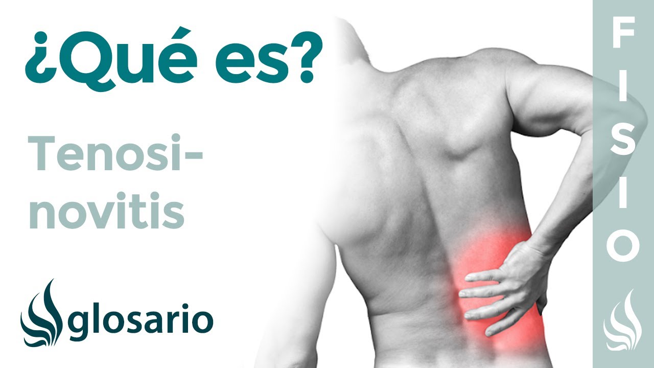 cuáles son las causas de la tenosinovitis