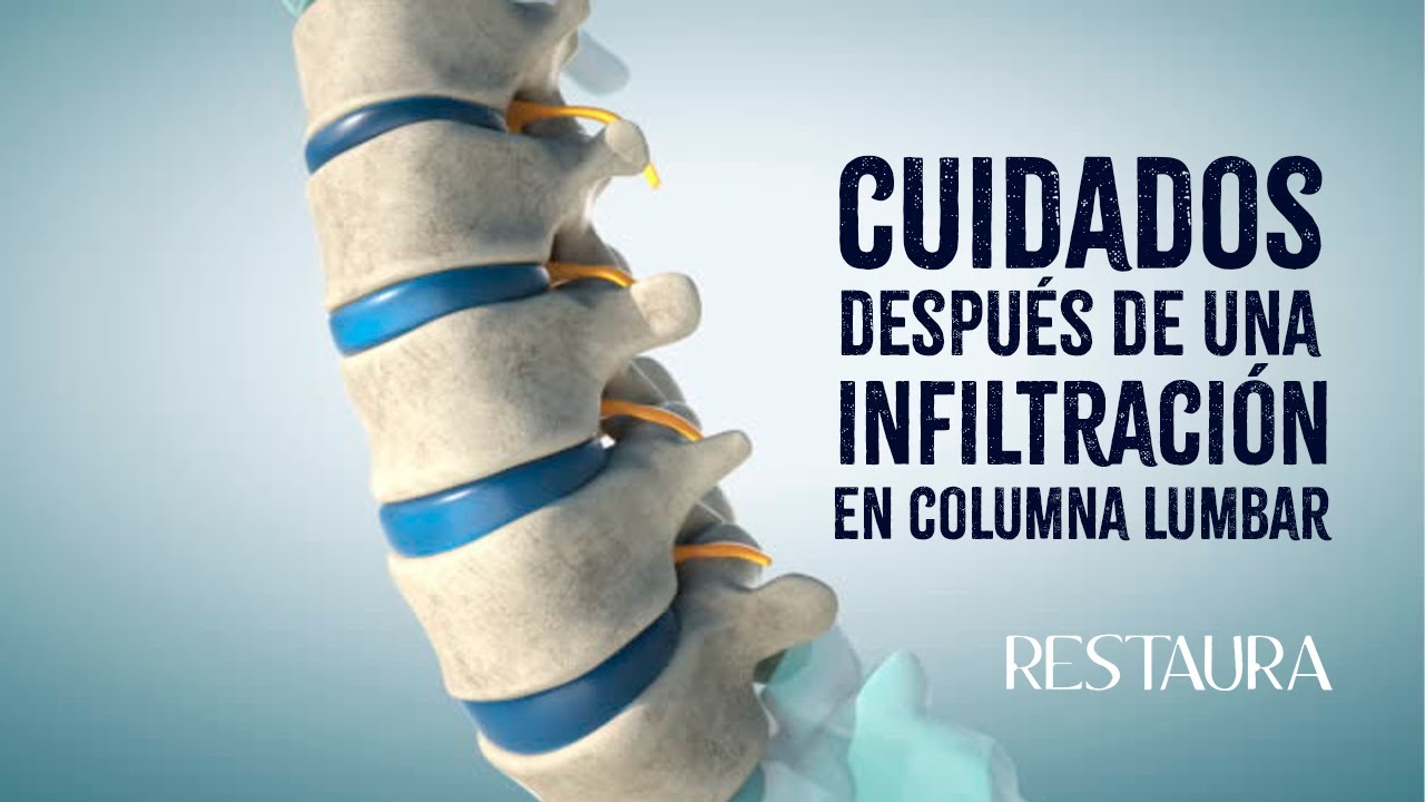 cuidados despues de un bloqueo lumbar
