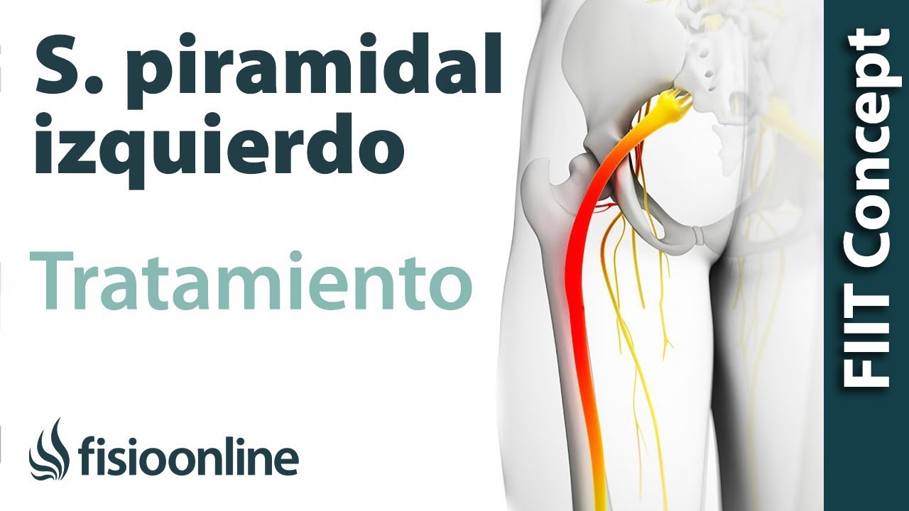dolor muscular en el gluteo izquierdo