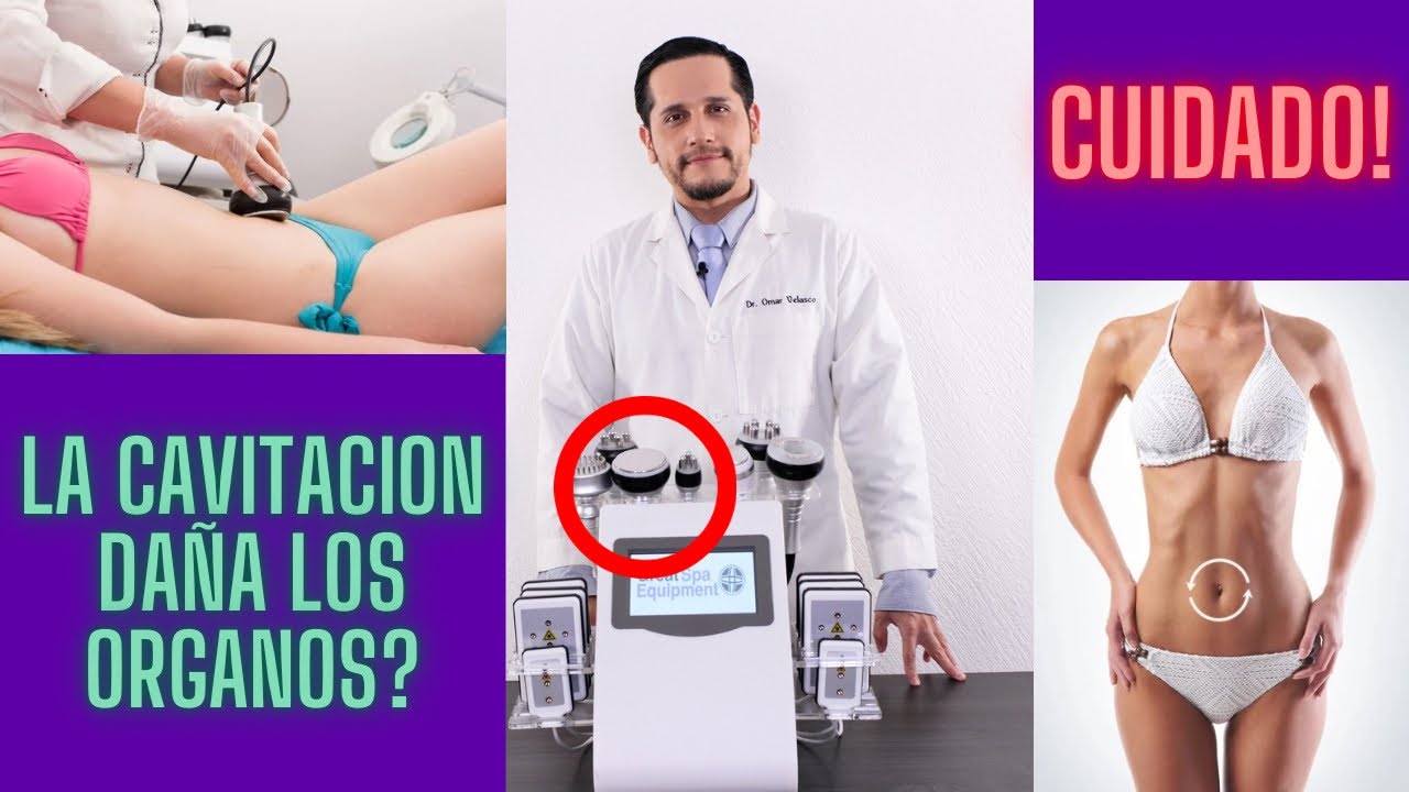 la cavitacion puede dañar el oido