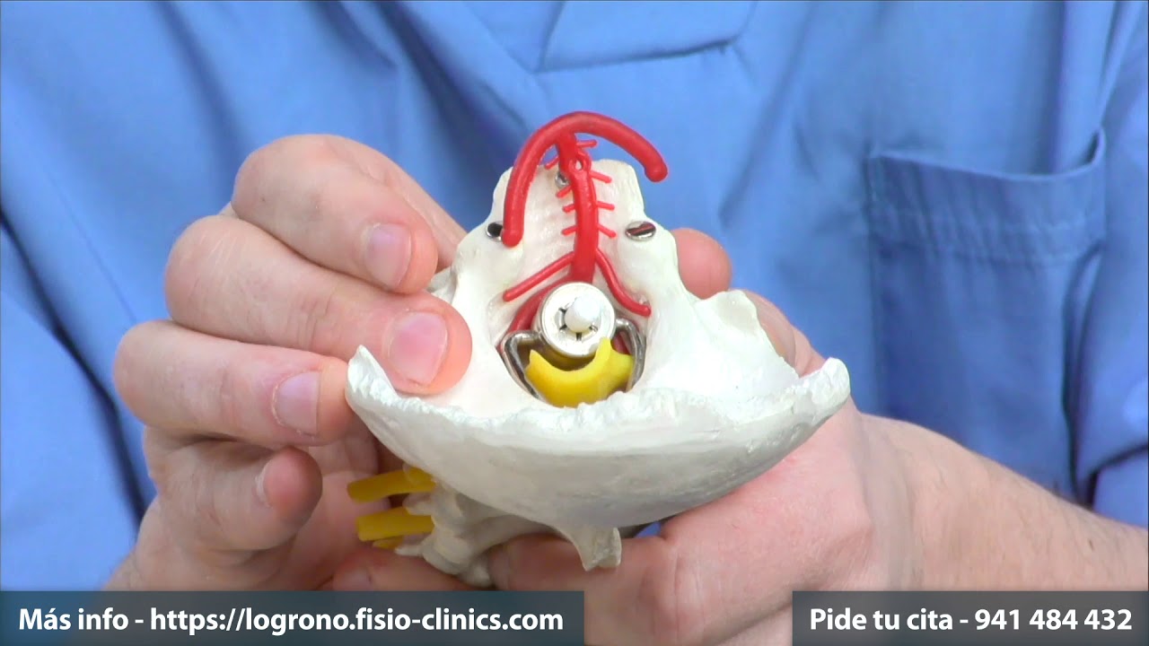 mareos por contractura en el cuello