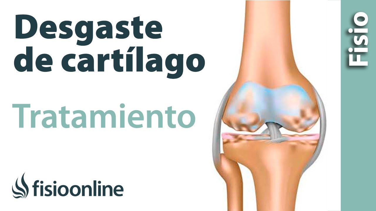 medicamentos para el desgaste de cartilago