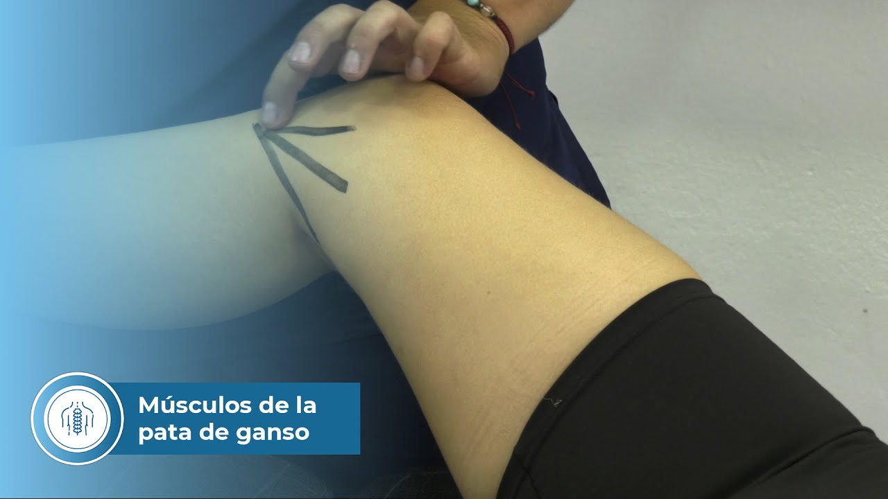 musculos que forman la pata de ganso