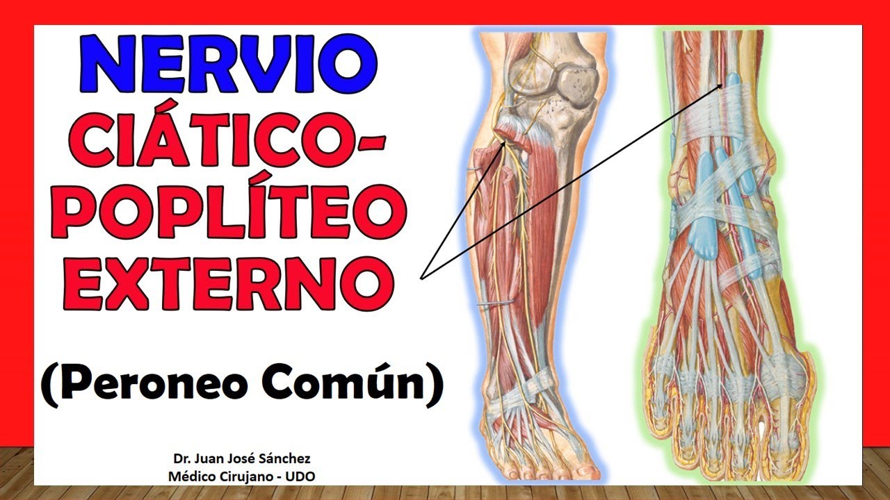 nervio ciatico popliteo externo o peroneo