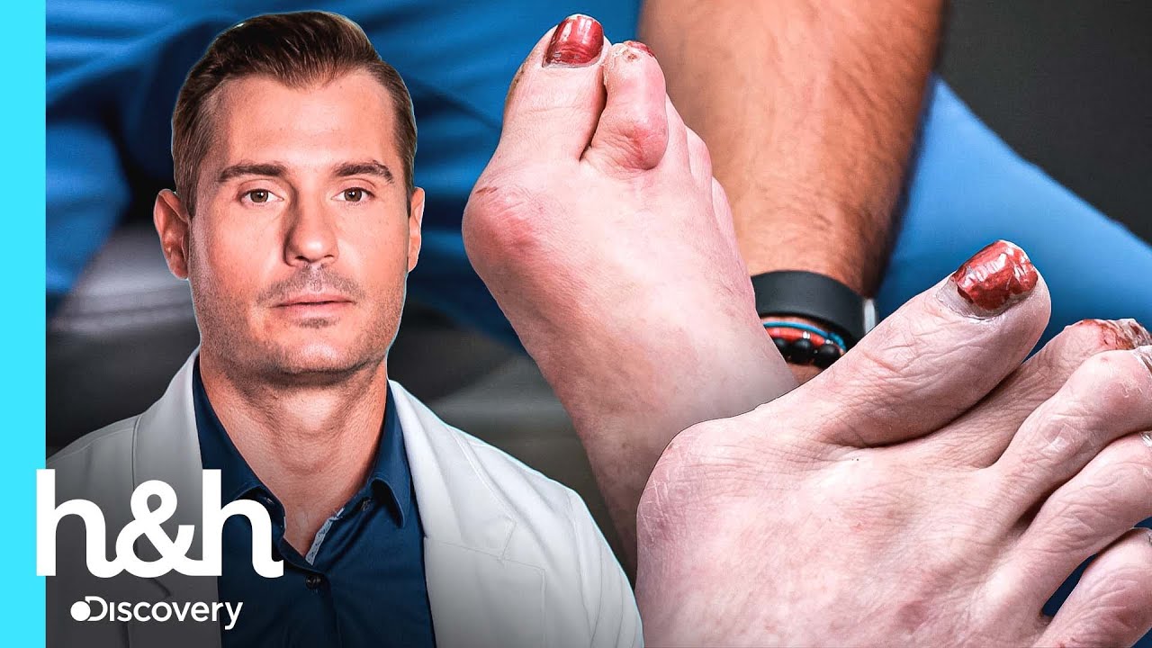 pie de bailarina de ballet enfermedad