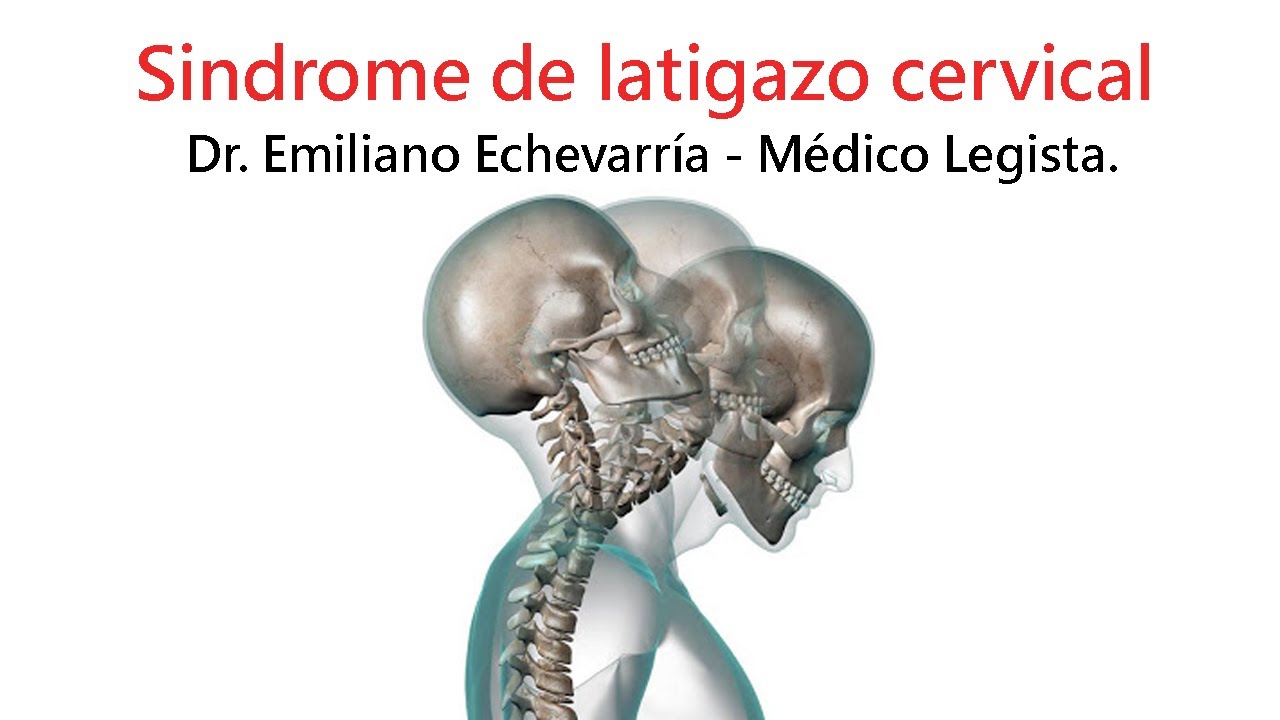 puntos de secuelas por latigazo cervical