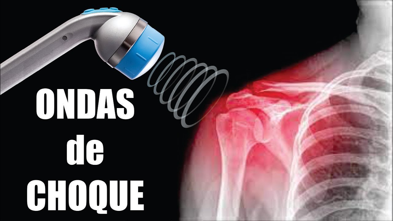 que son las ondas de choque