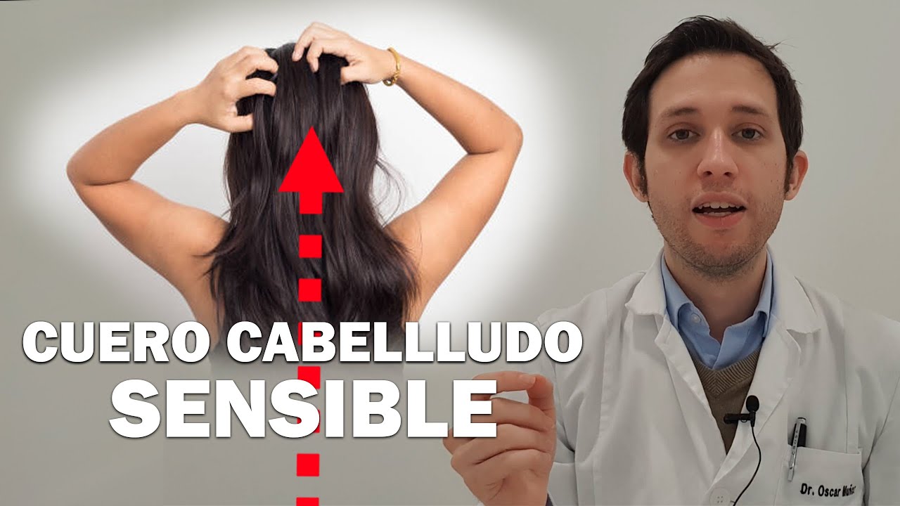 sensibilidad en el cuero cabelludo causas