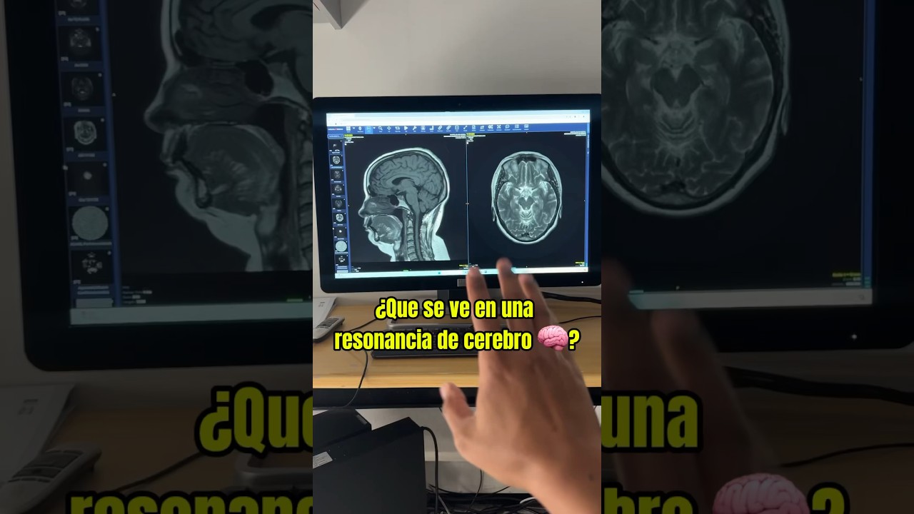 si ven algo malo en una resonancia te llaman