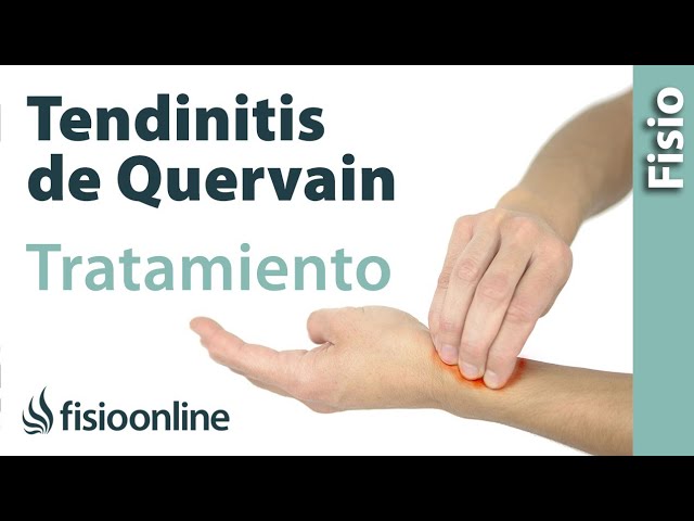 tendinitis dedo pulgar mano derecha tratamiento