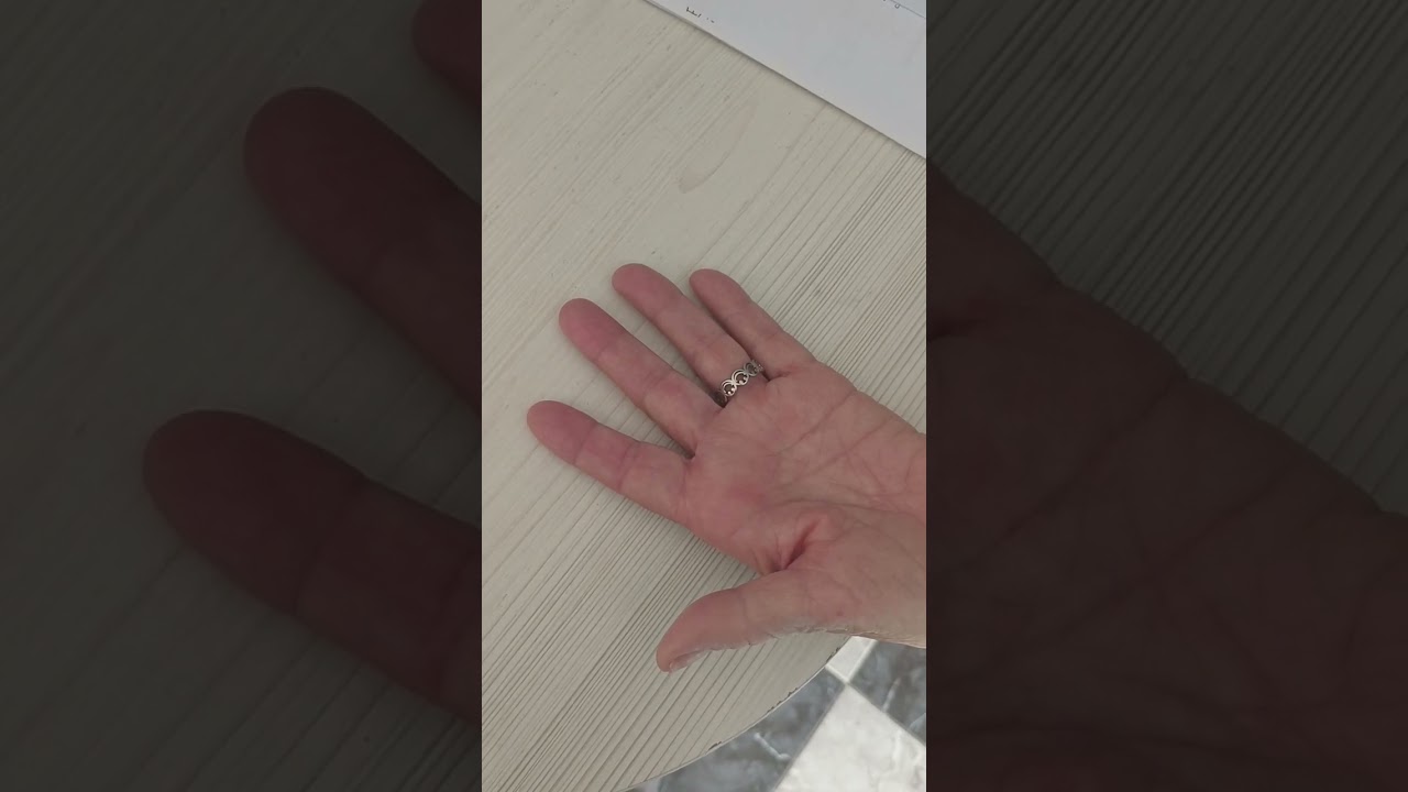 tendones flexores y extensores de la mano
