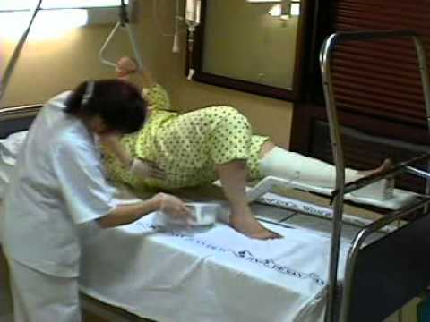 como mover a una persona con fractura de fémur