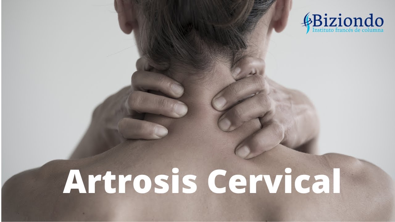 cuáles son los síntomas de artrosis cervical