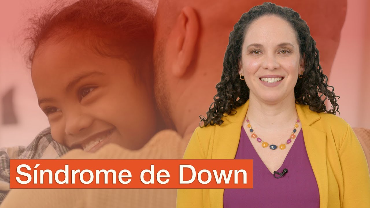 curiosidades sobre el sindrome de down